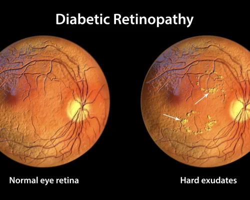 Depositphotos_567244026_XL-scaled