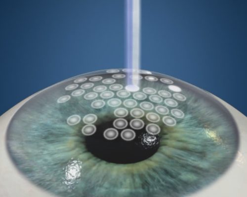 NAR_PRK_Ovr_fullscreen_poster