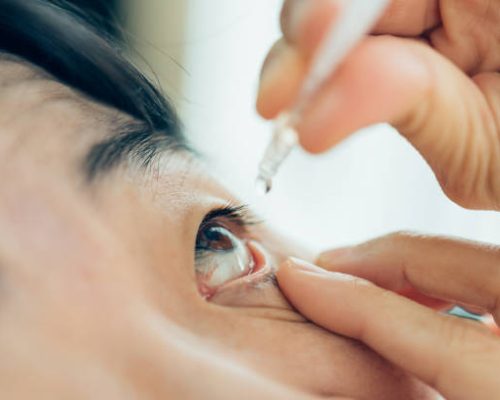 Asian woman use eye drop or artificial tears by drops in to the eye for inflammation or dryness problem therapy of eyeball for eyes health