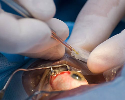 istockphoto-92027522-612x612