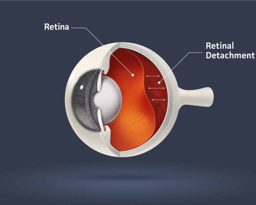 shutterstock_13969633-scaled